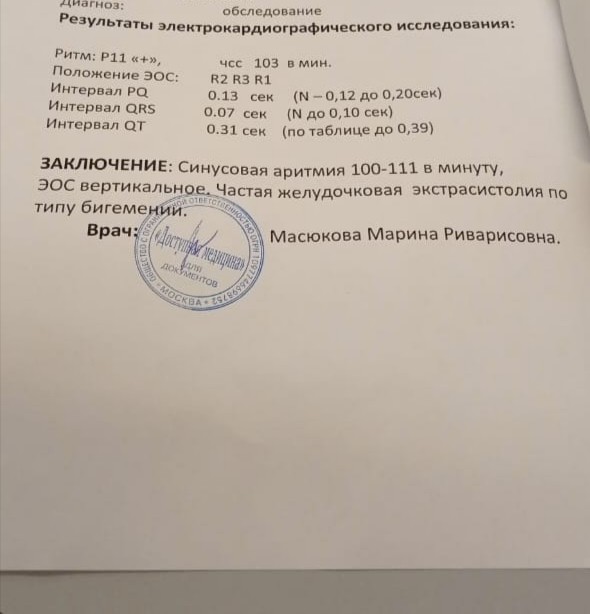 G 90.8 диагноз. Заключение ЭКГ У детей. Расшифровка заключение ЭКГ У ребенка. Заключение ЭКГ ребенка 5 лет. Заключение ЭКГ ребенка 3 года.