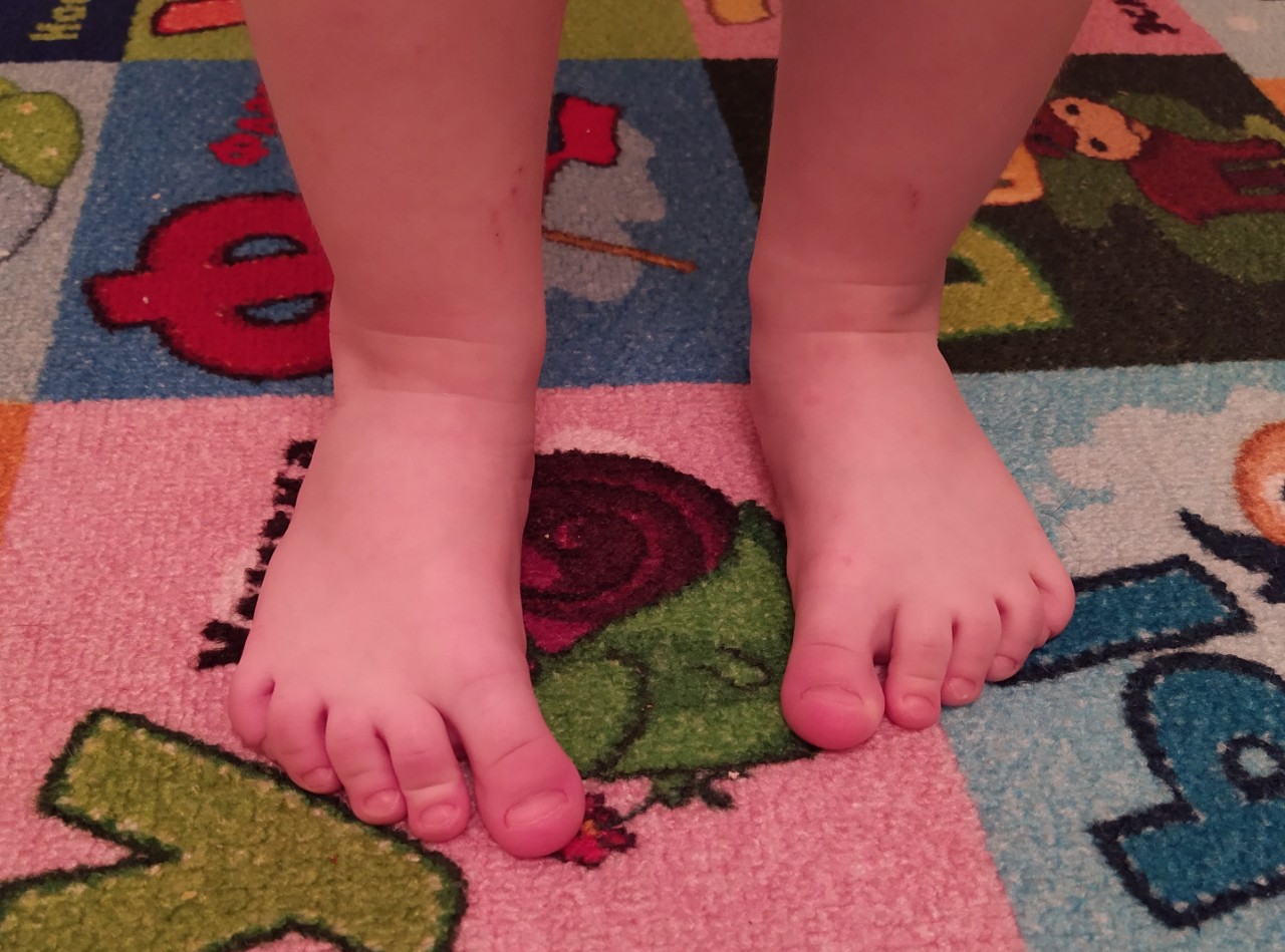 Детские пальчики на ногах