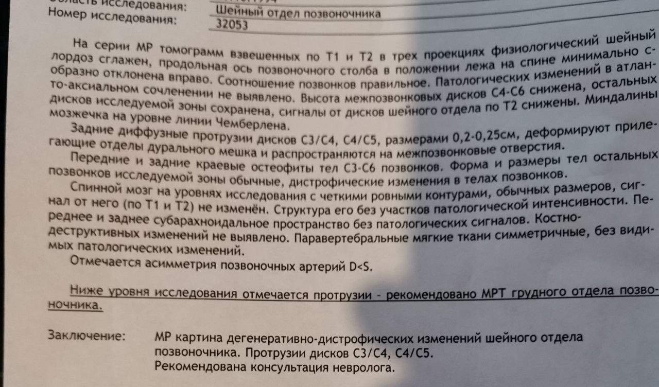 Синдром позвоночной артерии отзывы. Мрт Лидер заключение протрузия.