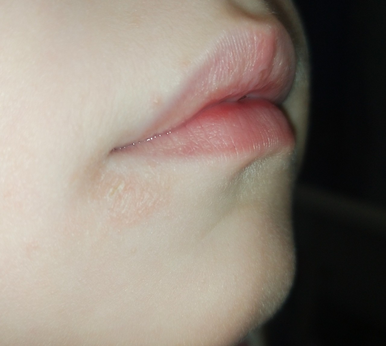 фото белых губ