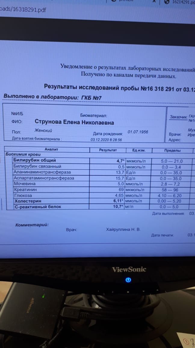 Опасен ли фиброз легких для жизни после ковида