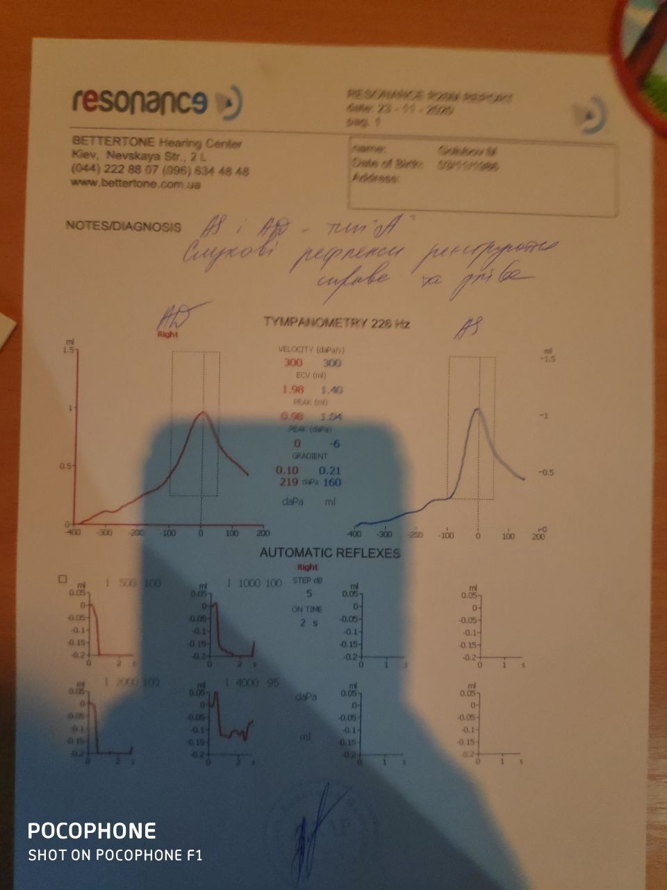 Появилась вибрация в машине