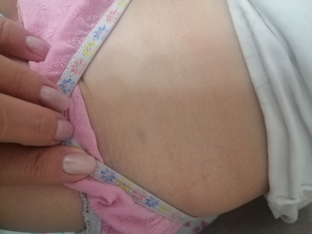 синяк на груди беременность фото 103