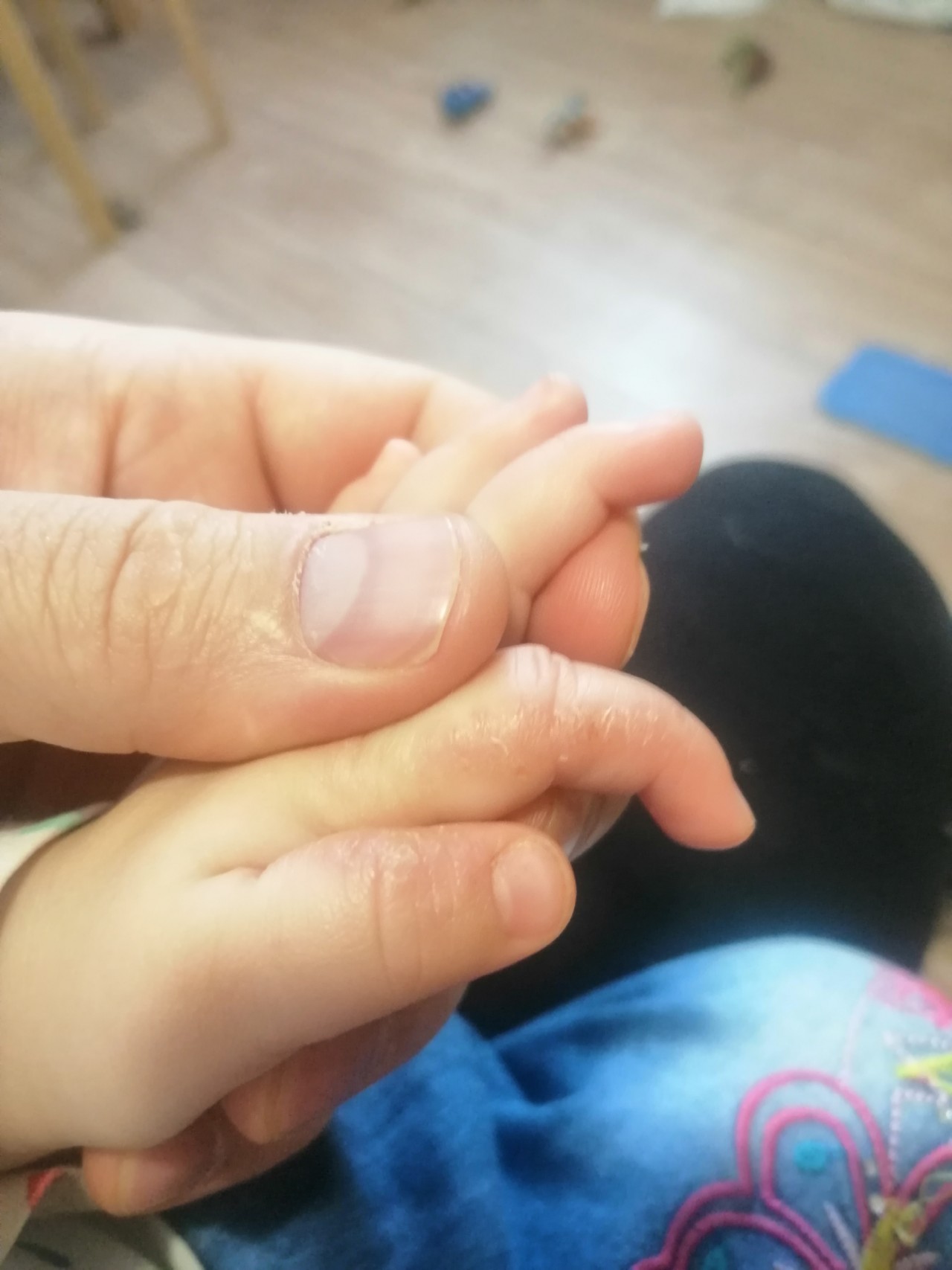 На пальцах появляются трещины - Вопрос дерматологу - 03 Онлайн