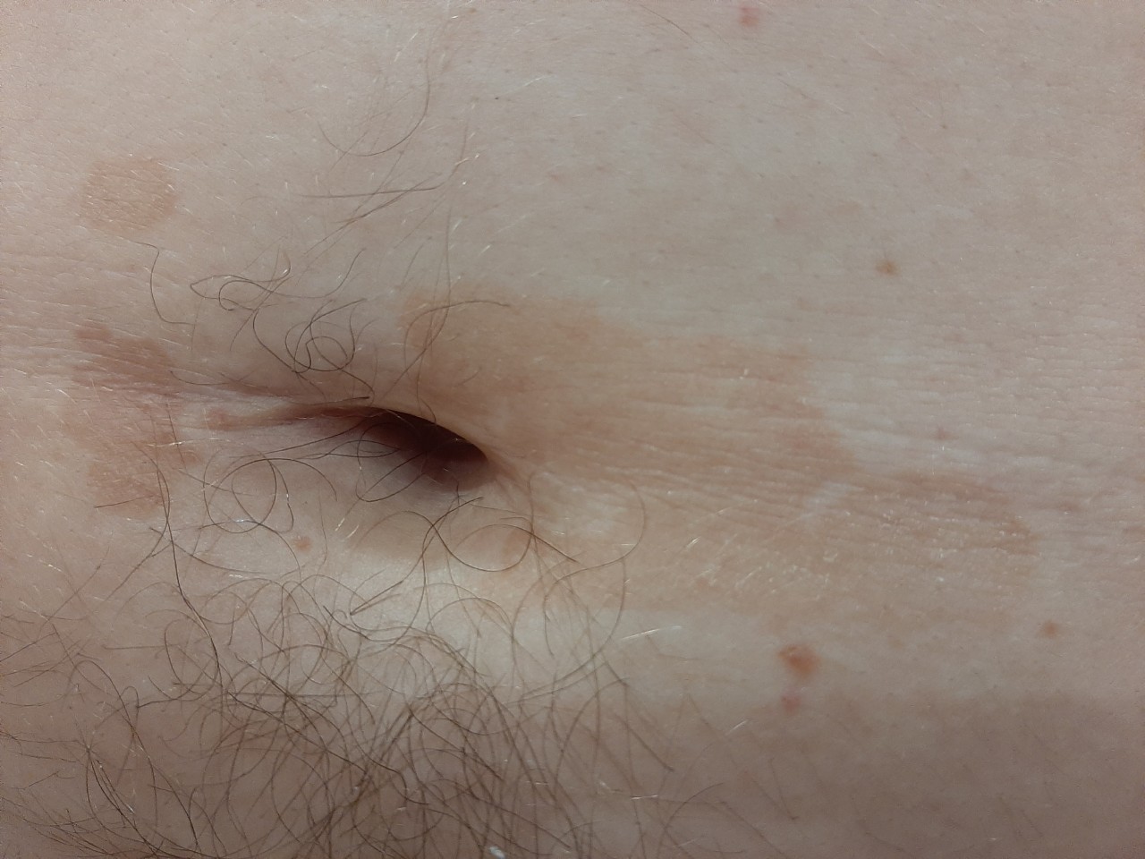 коричневые пятна на груди беременность фото 108