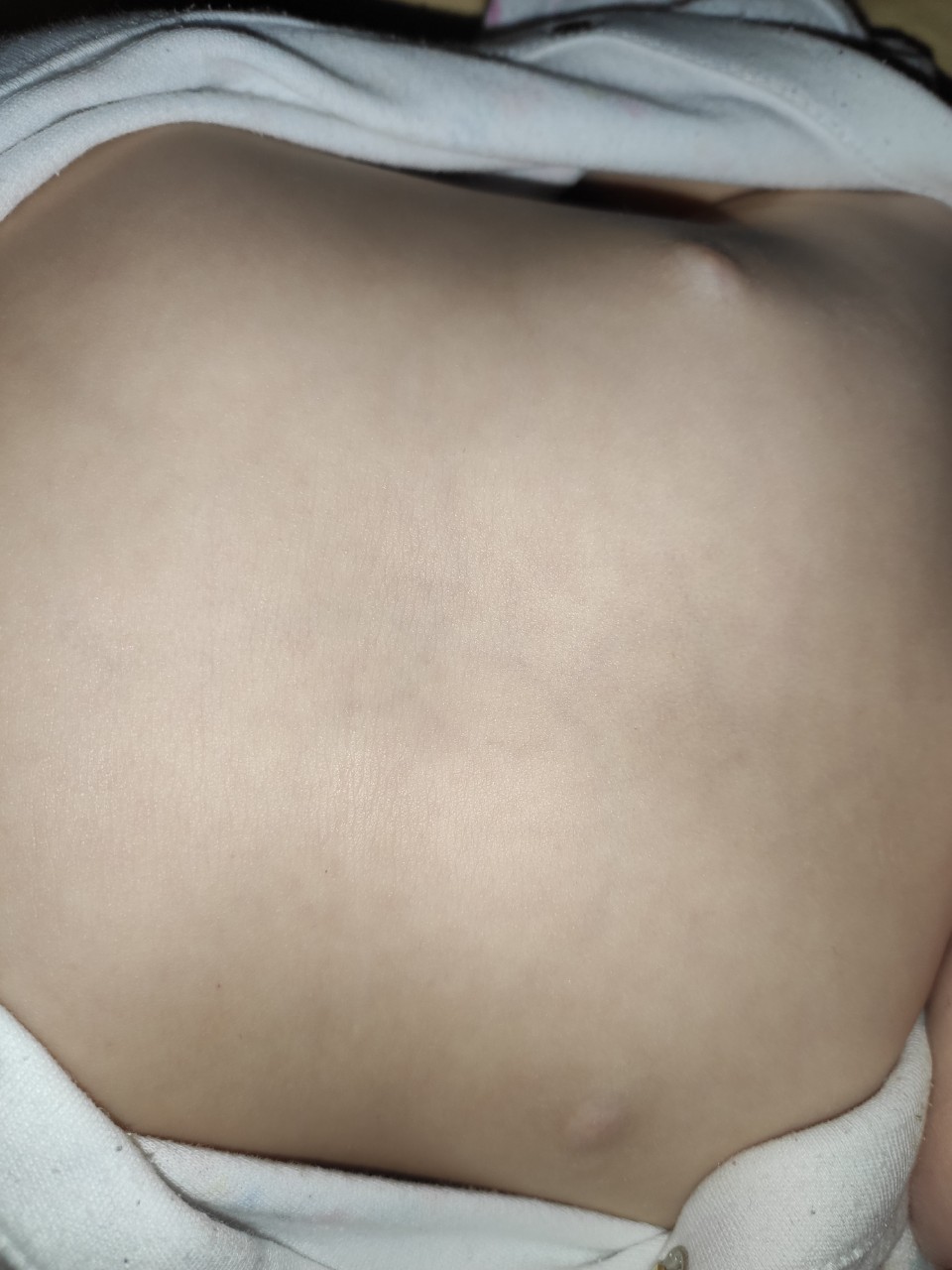 могут ли быть уплотнение груди при беременности фото 49