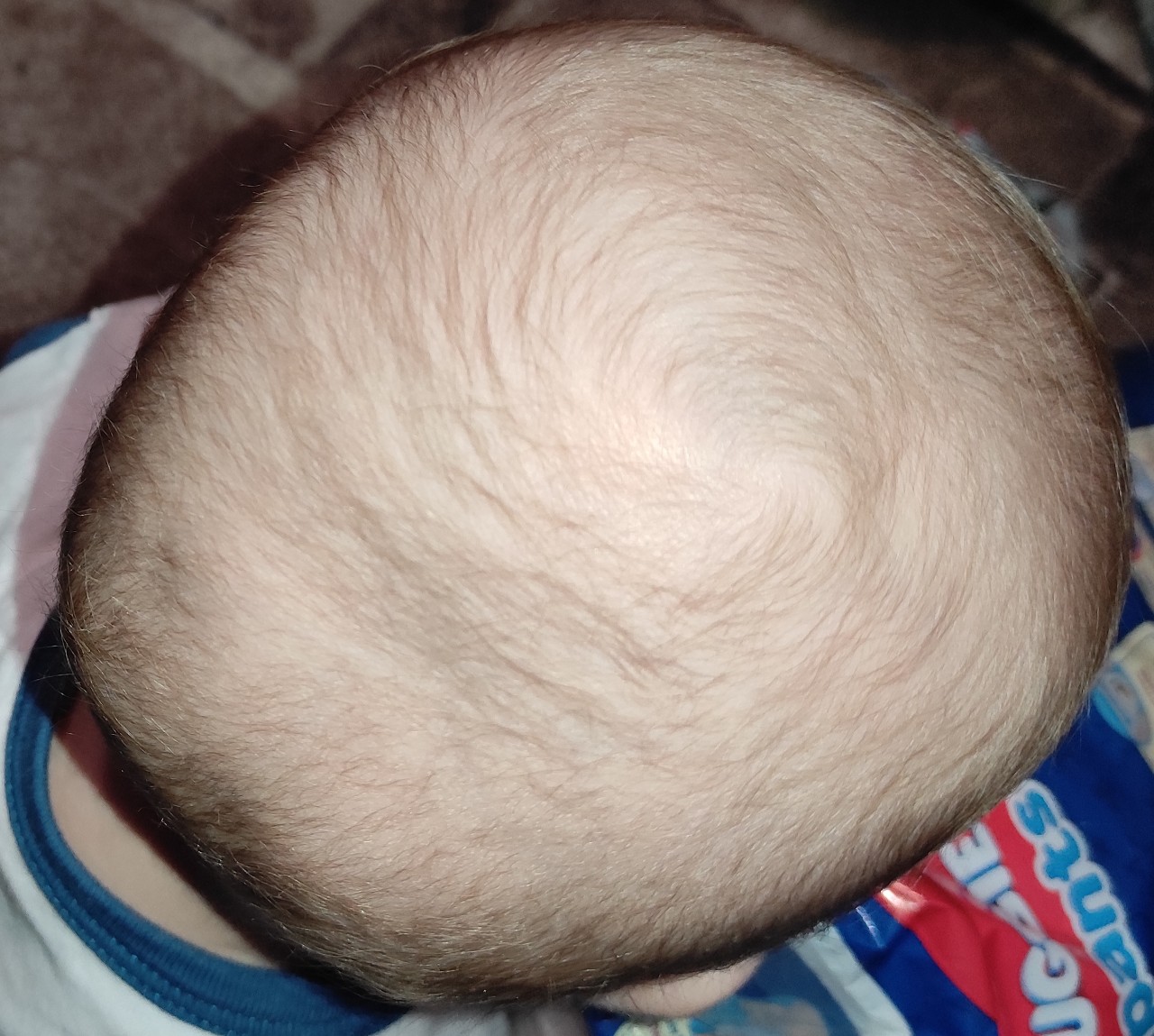 череп новорожденного фото