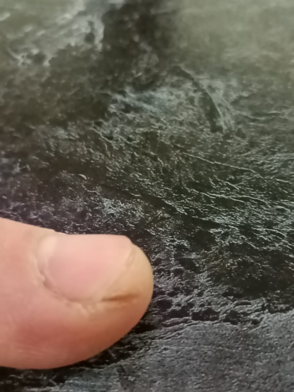 Трещины на подушечках пальцев