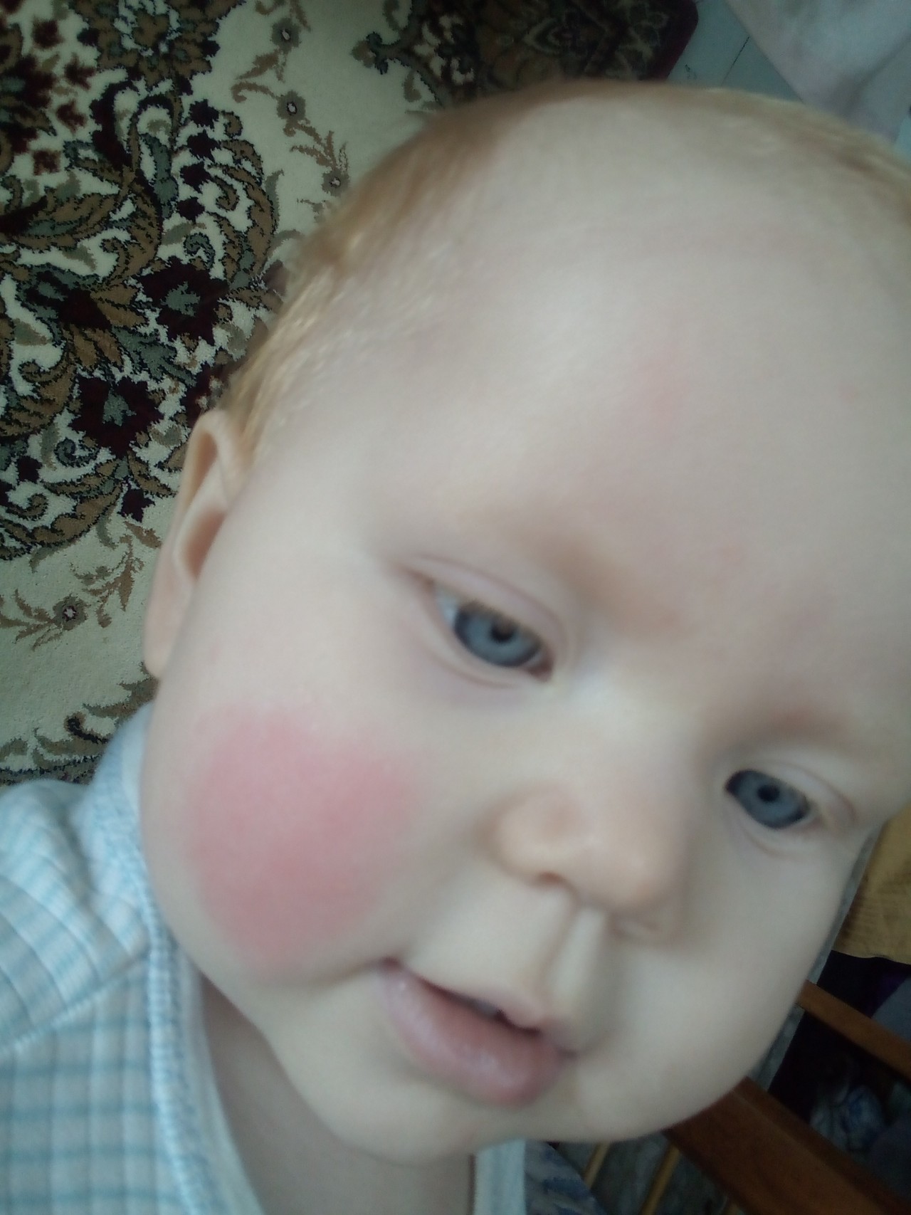 Горячая щека у ребенка. Покраснение на щеке у ребенка. Красное пятнышко на щеке у ребенка.