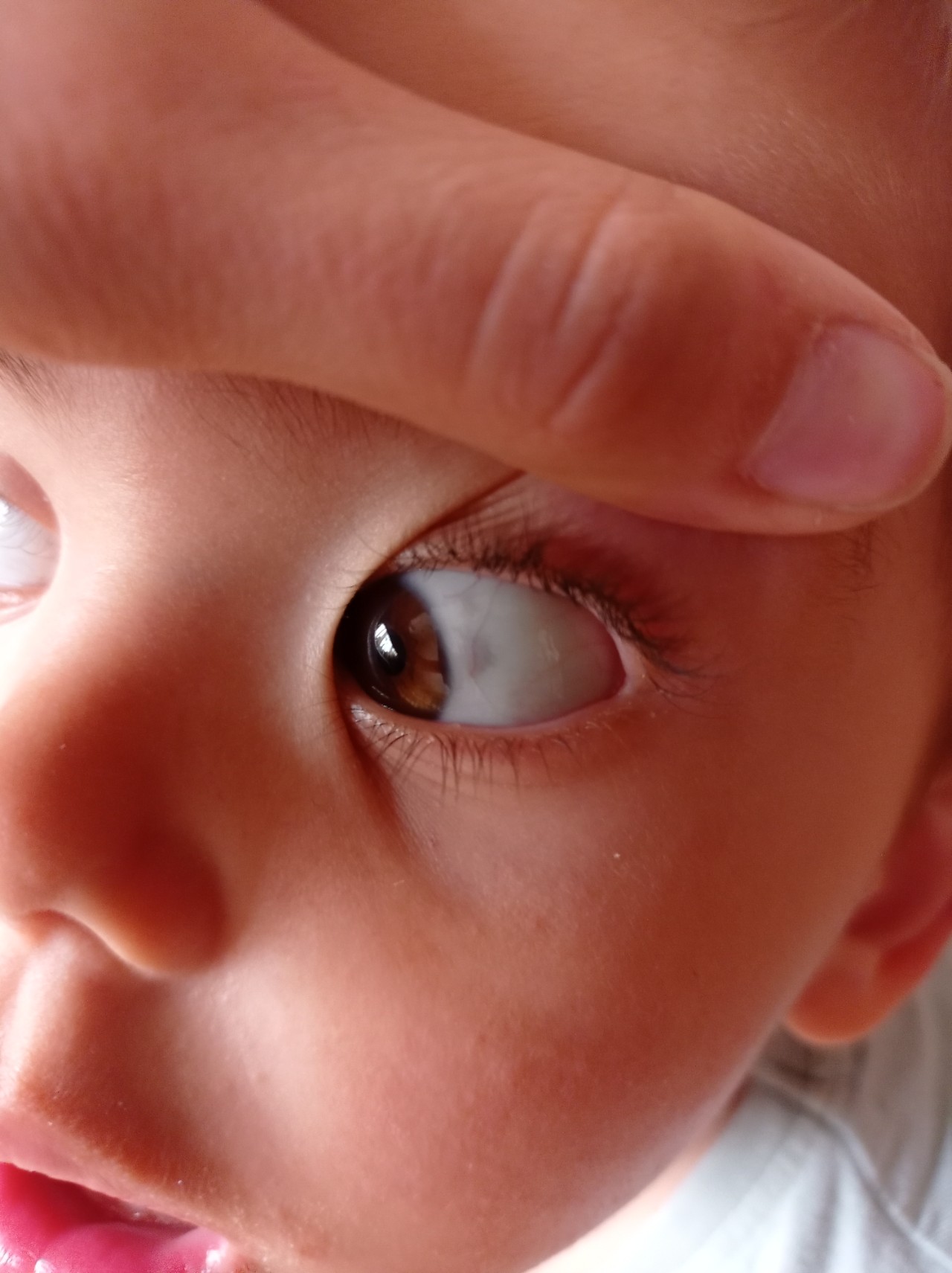 Белки глаз новорожденного. Темное пятно на белке глаза. Пятнышко на глазу у ребенка.