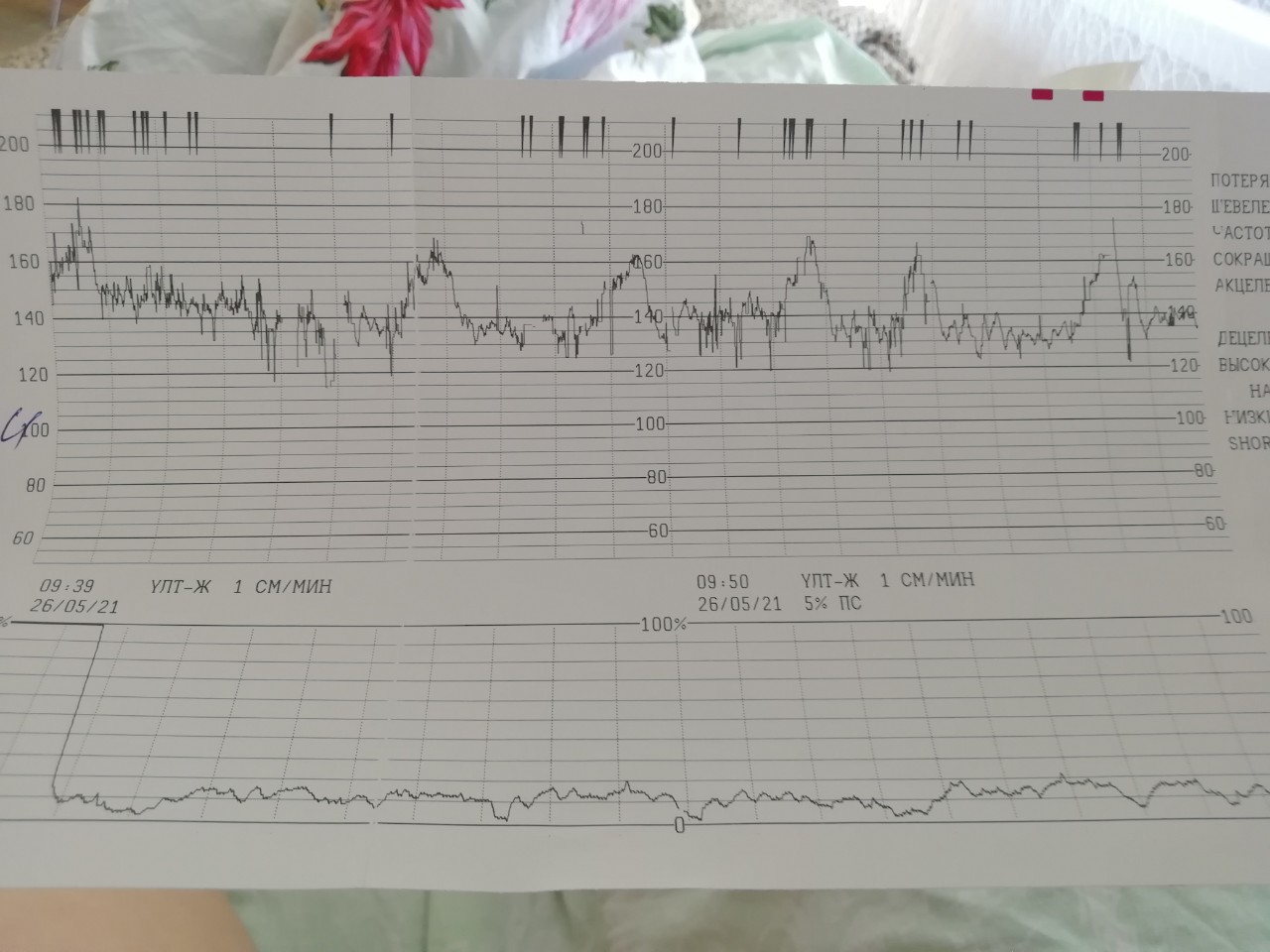 Ктг на 39 неделе беременности