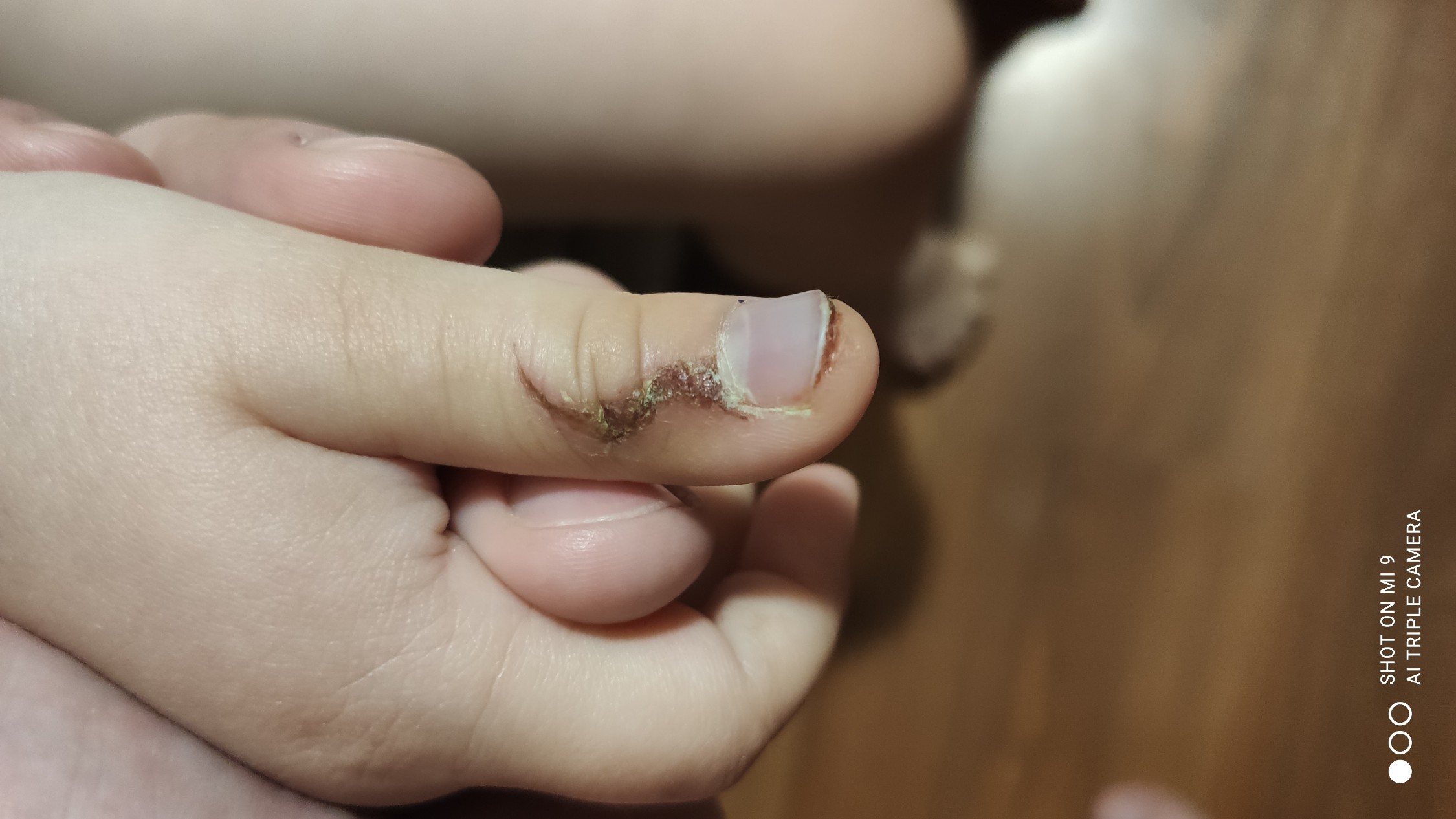 Частное фото палец в попе