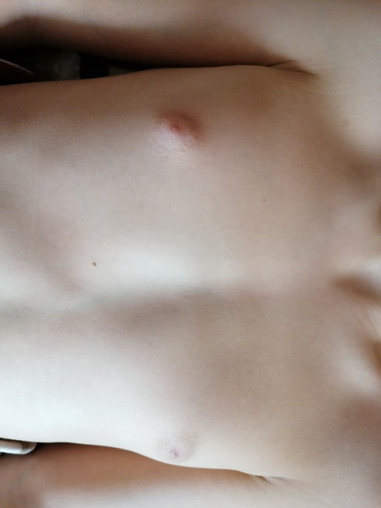 к чему чешется правая грудь у женщин фото 114