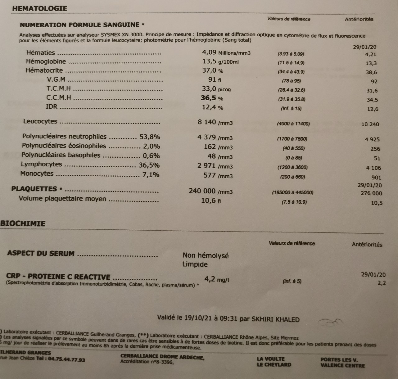 Анализ крупно. Пролактин гормон расшифровка анализа крови. Пролактин обозначение в анализах. Антитела к ТТГ повышены.