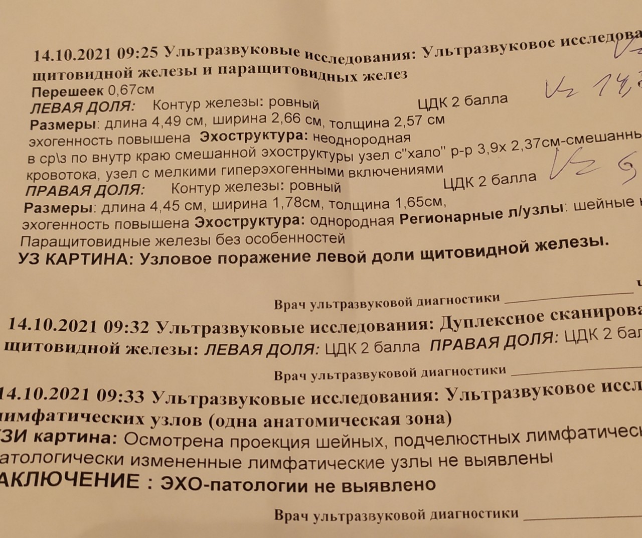 Щитовидная железа узлы размеры. Объем узла щитовидной железы. Допустимые Размеры узлов на щитовидной железе. Размер узелков в щитовидке допустимый.