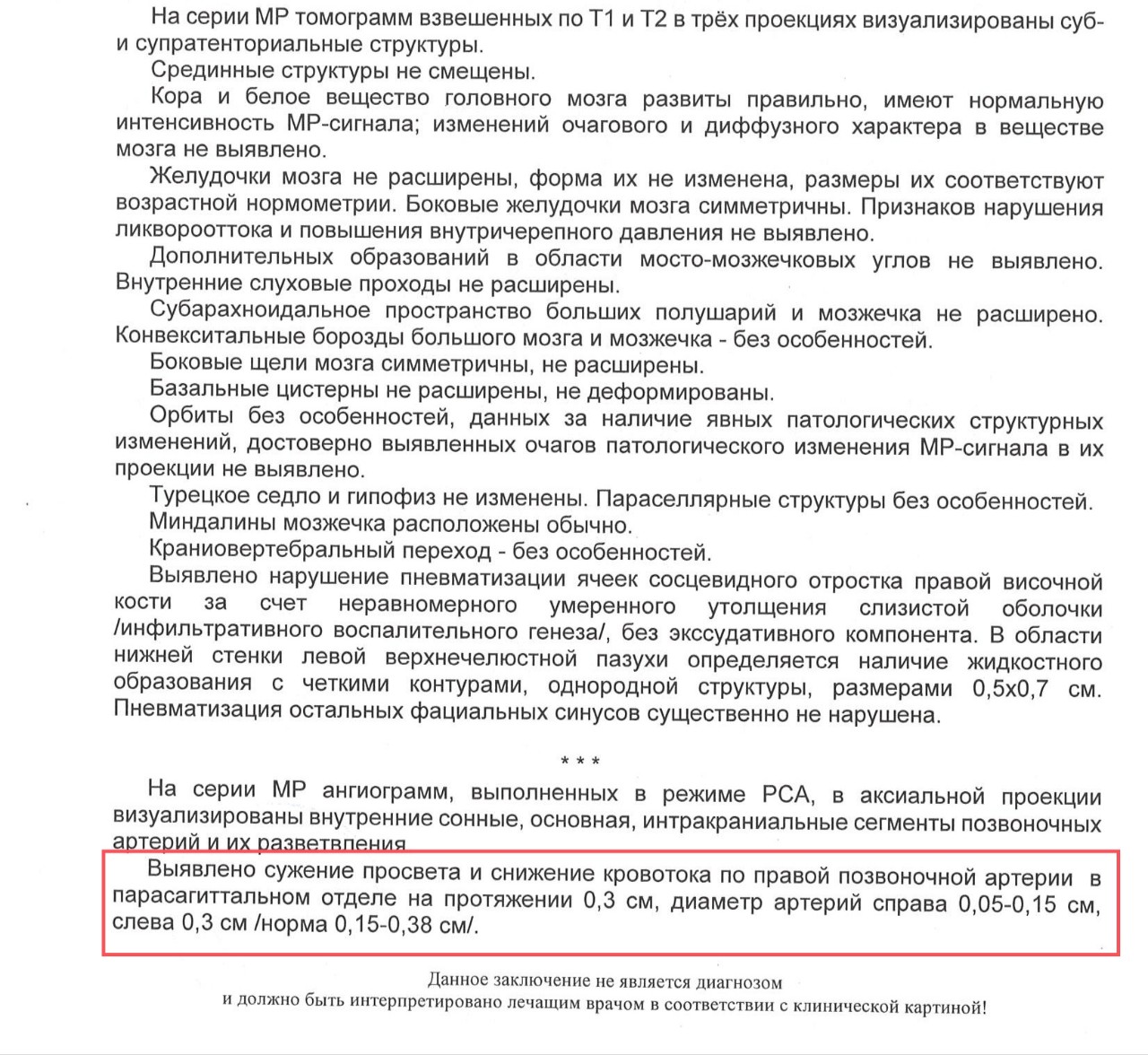 Картина развития виллизиева круга в виде снижения кровотока по обеим задним соединительным артериям