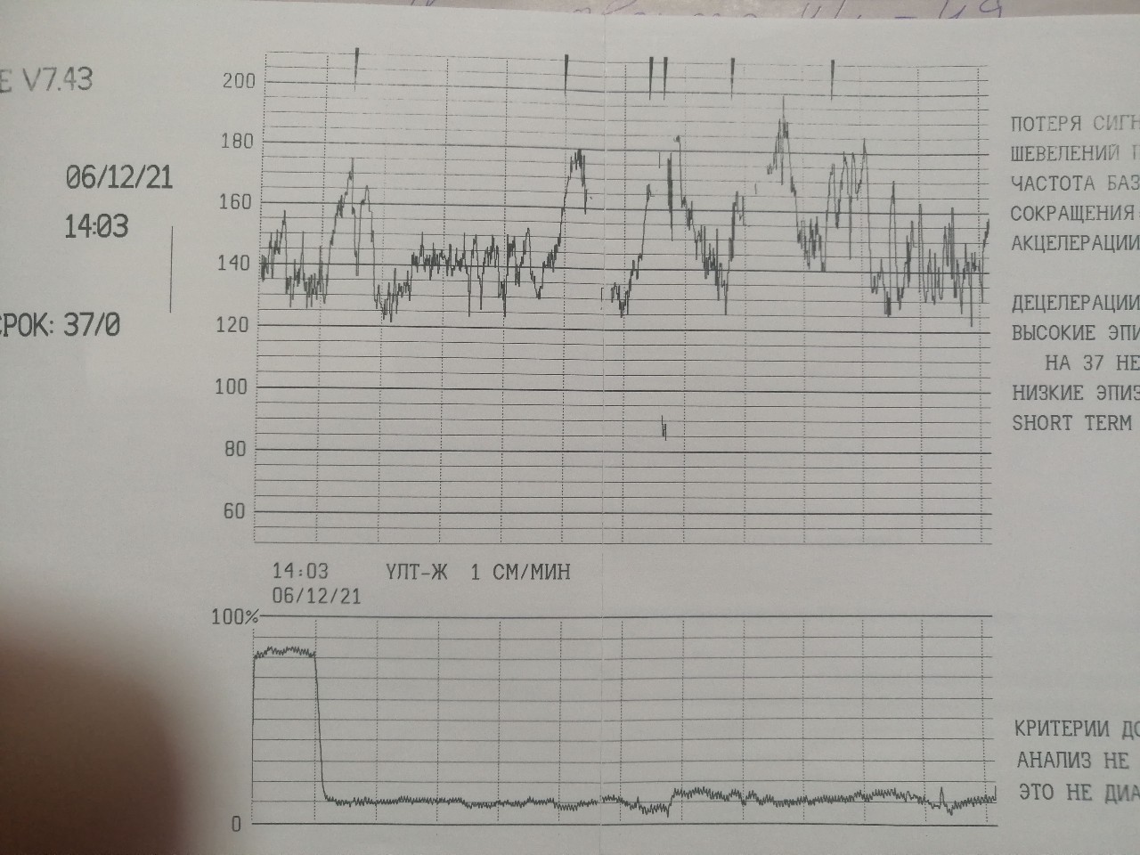 Ктг 37 недель норма