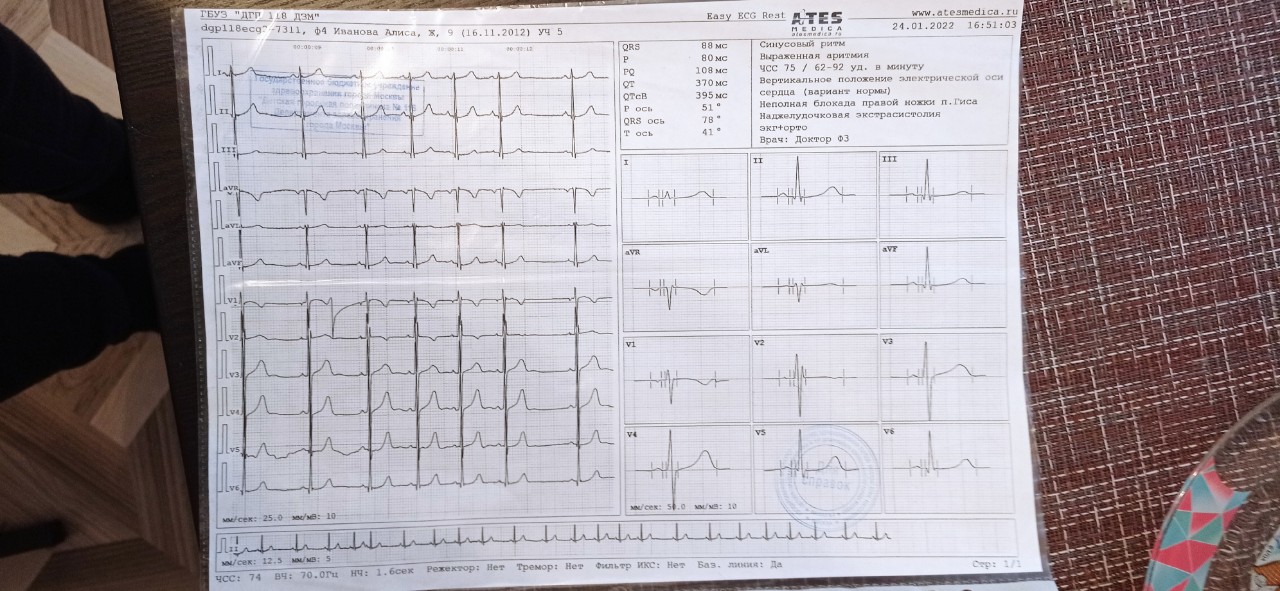 Экг поликлиника 2