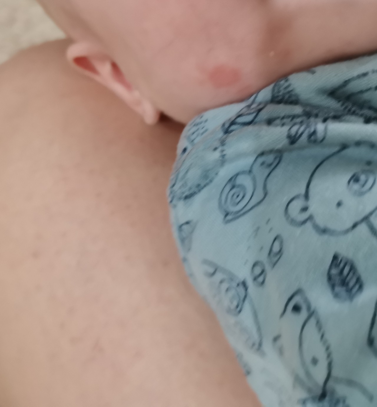 у новорожденного припухла одна грудь фото 107