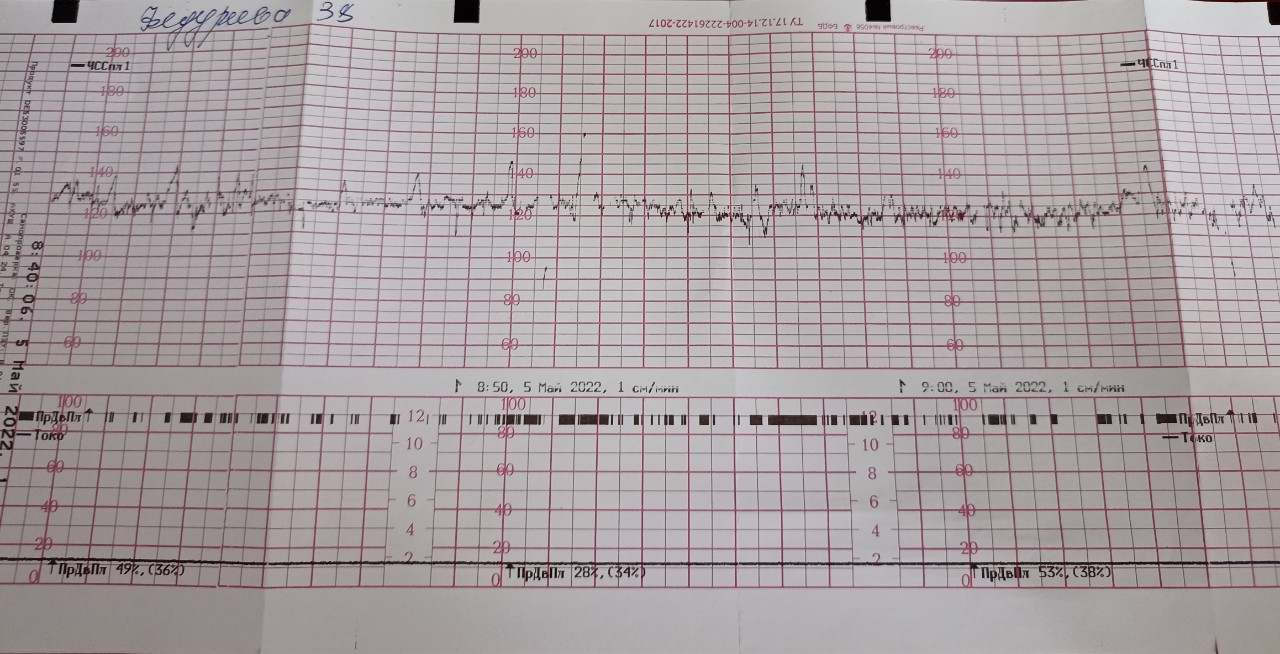 Ктг на 39 неделе беременности