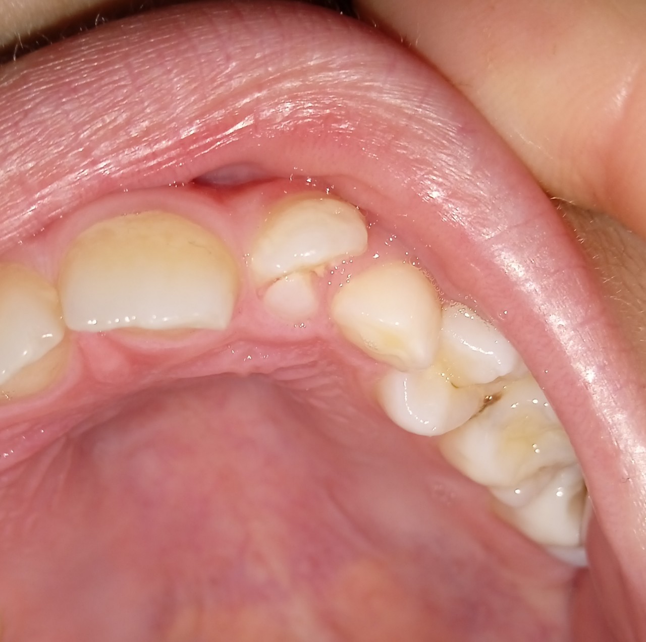 Стоматология - Вопрос стоматологу - 03 Онлайн