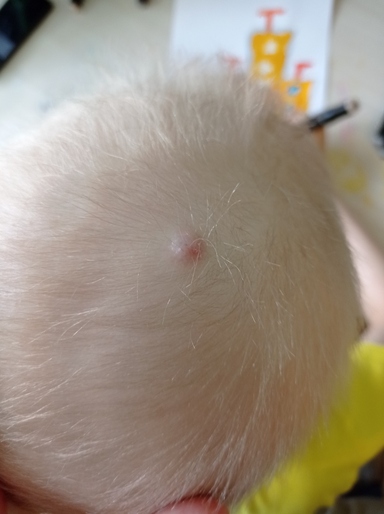грибок на голове у ребенка фото