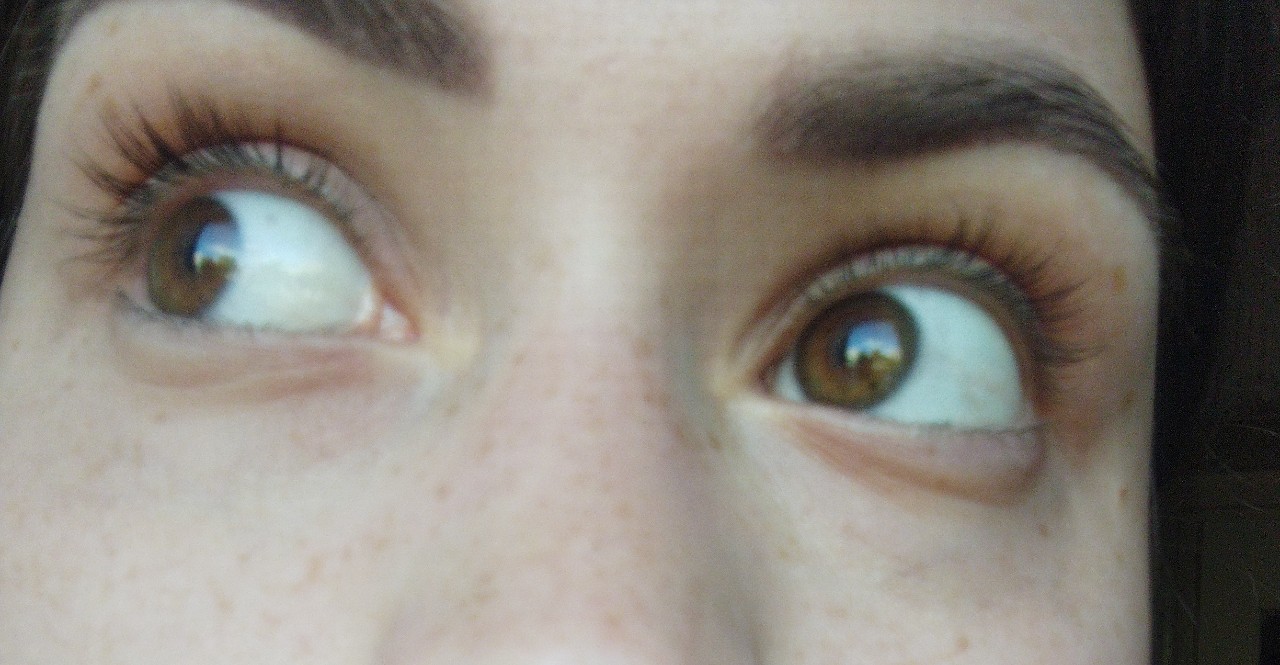 Почему глаза желтоватого. Чуть желтоватые белки глаз. Слегка желтые белки глаз.