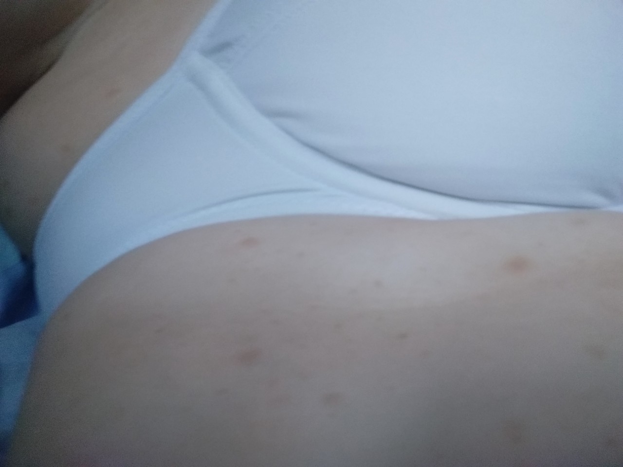 аллергия на груди у беременной фото 35