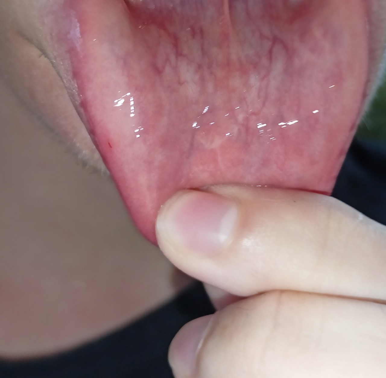 сперма на слизистой рта фото 17