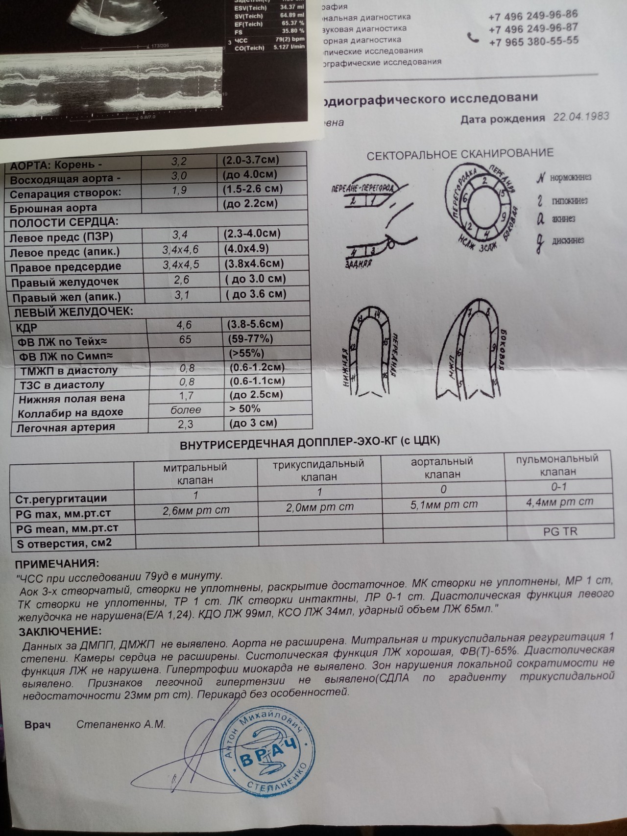 Митрально-трикуспидальная регидурация 1 степени - Вопрос кардиологу ...