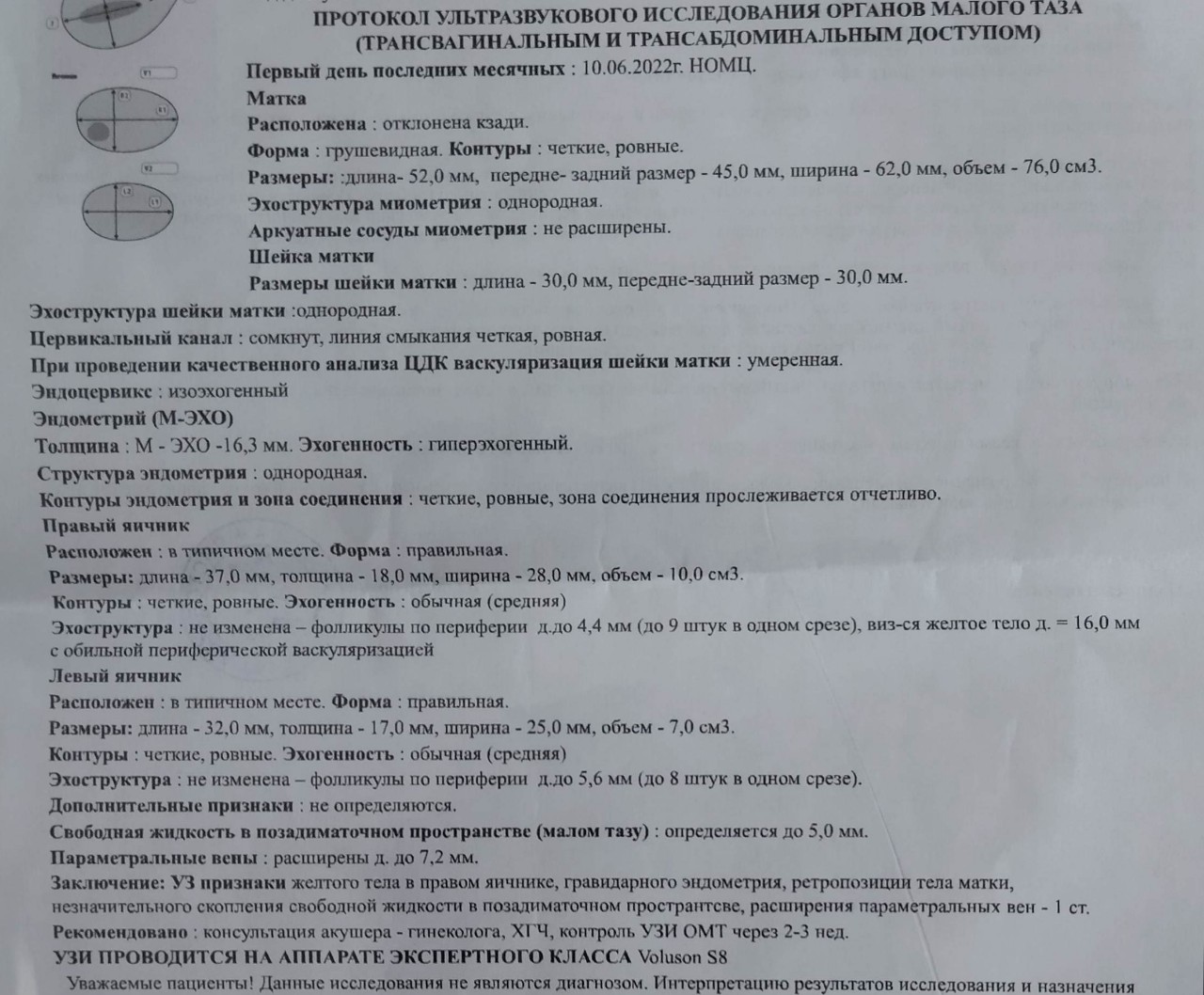 Боли внизу живота 32 недели беременности. Тест на беременность 2 недели. Тест на беременность 1 неделю перед месячными. Что может болеть на первой недели беременности.