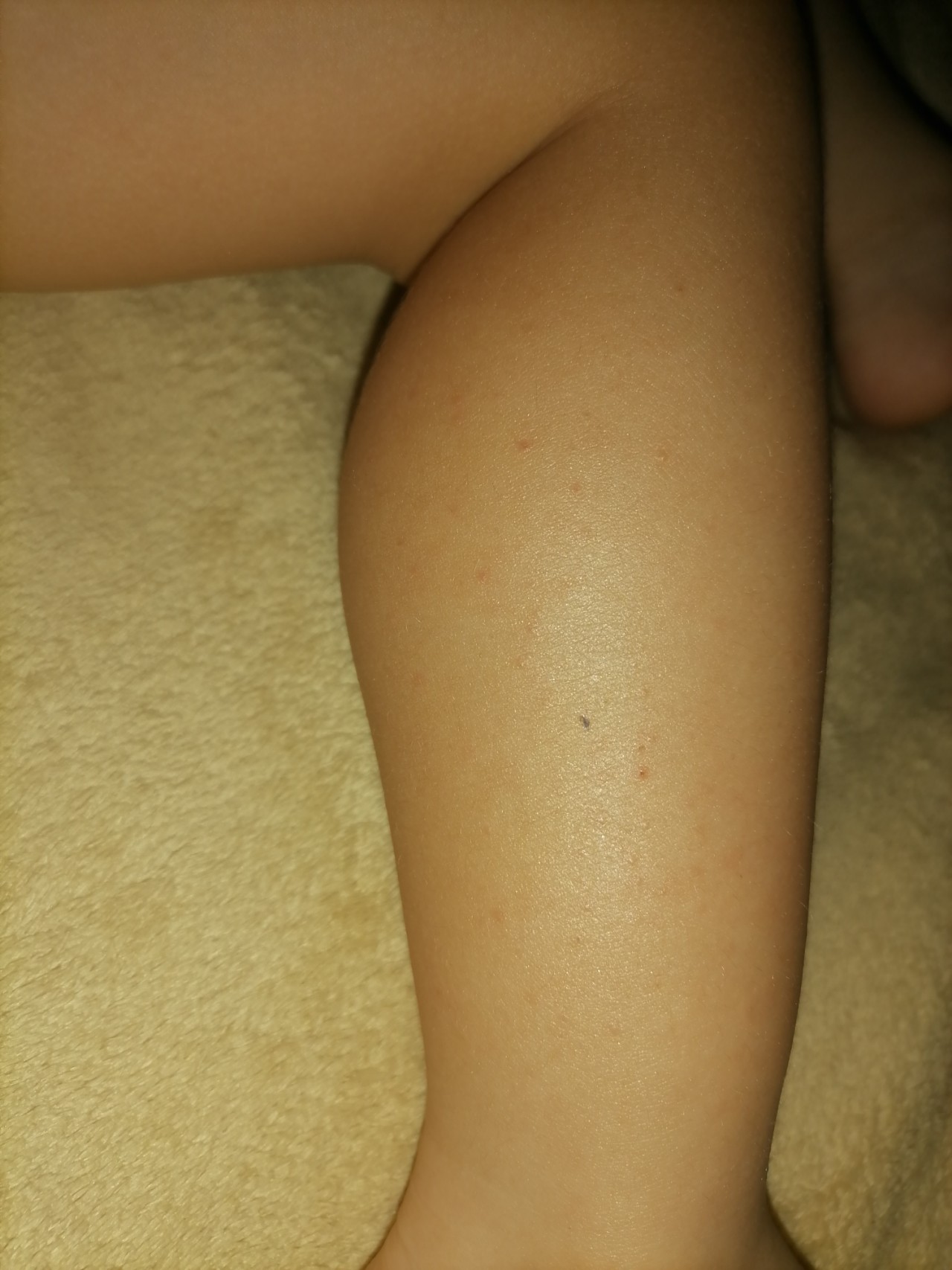 волосатые ноги у ребенка 6 лет фото 113