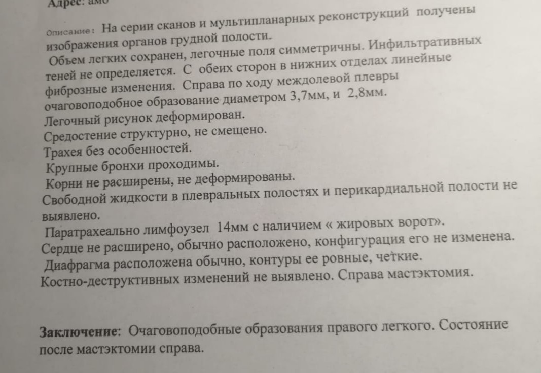 Легочный рисунок усилен за счет интерстициального компонента