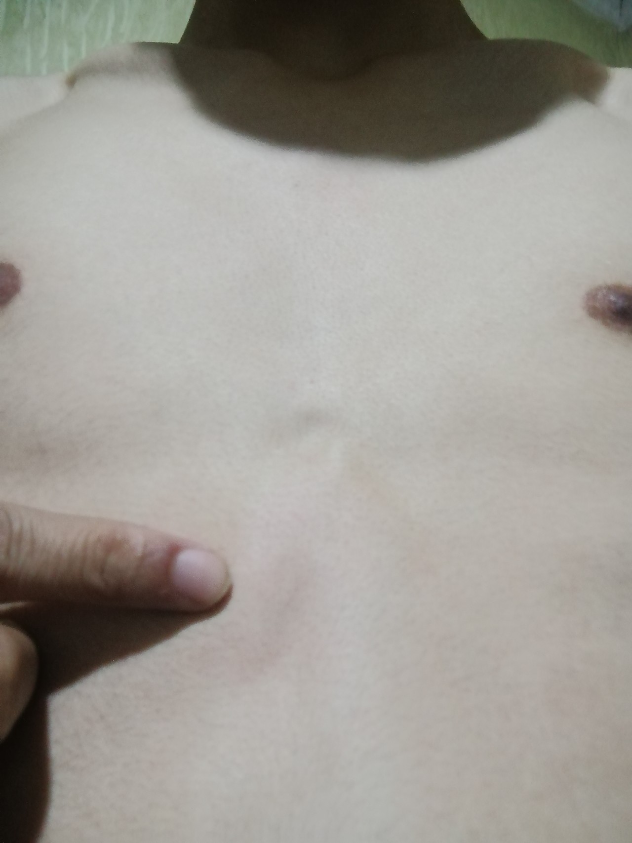 уплотнение в правой груди у мужчин что это фото 34