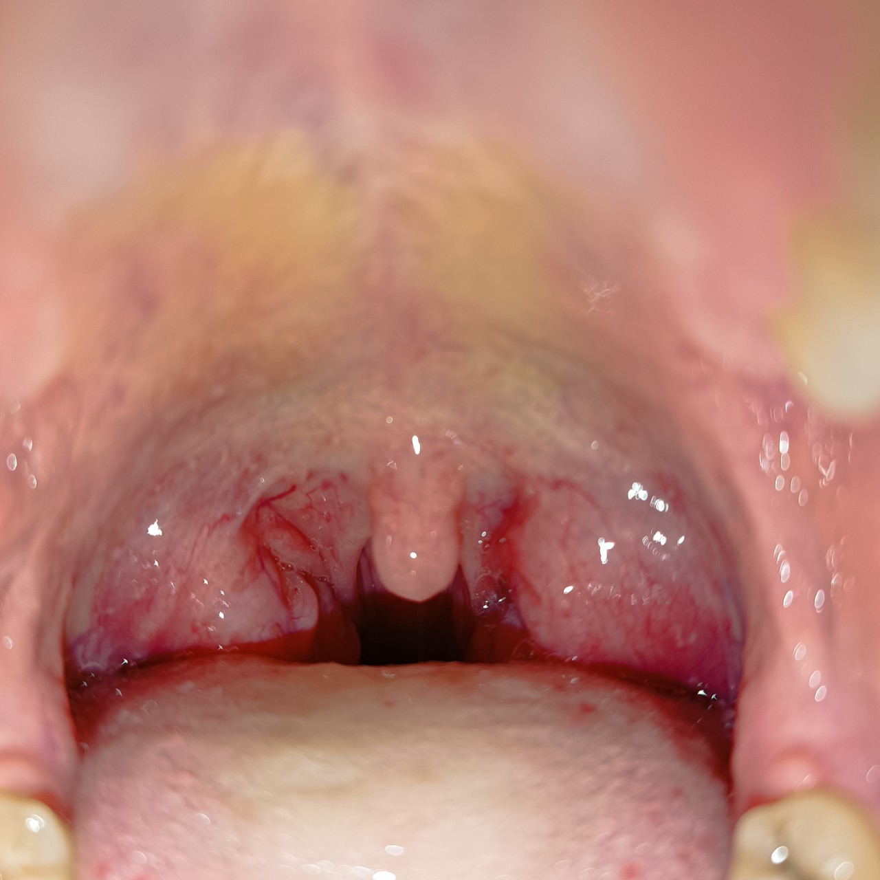 Susana and dayana medina