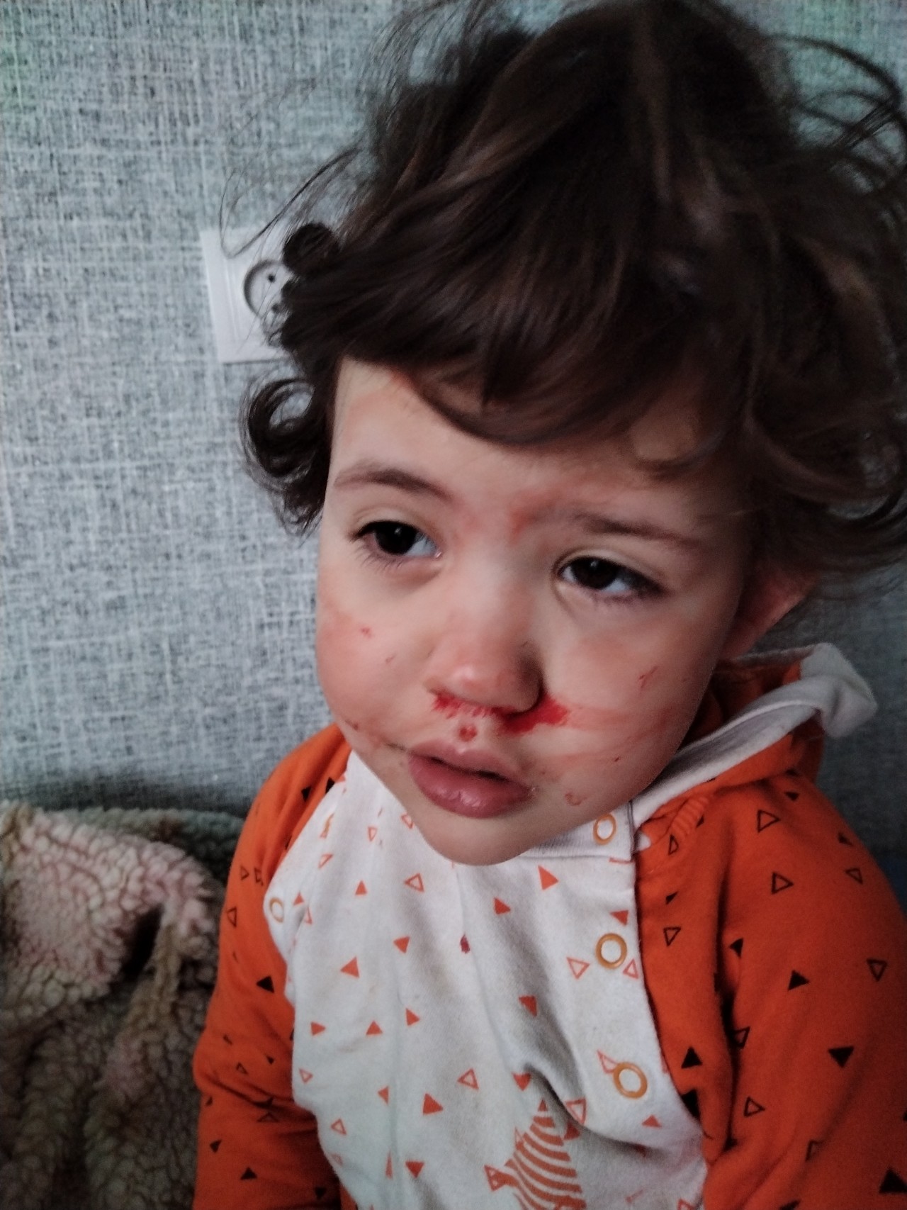 Кровь из носа у ребенка фото