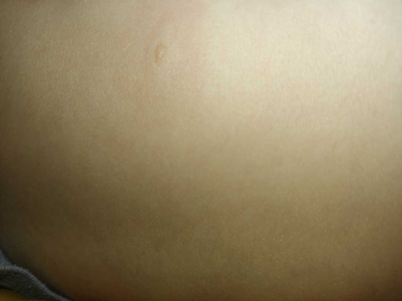 темные пятна на груди беременность фото 76