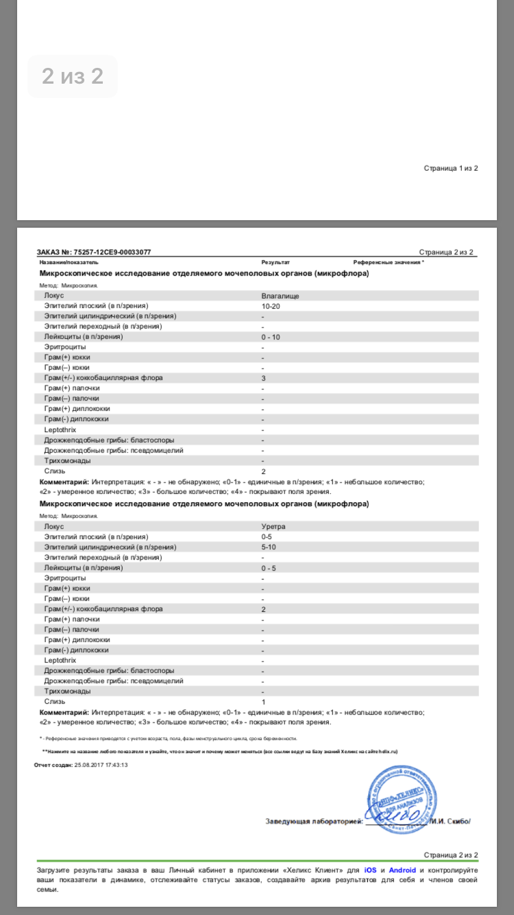 Микроскопическая исследования мазка у женщин