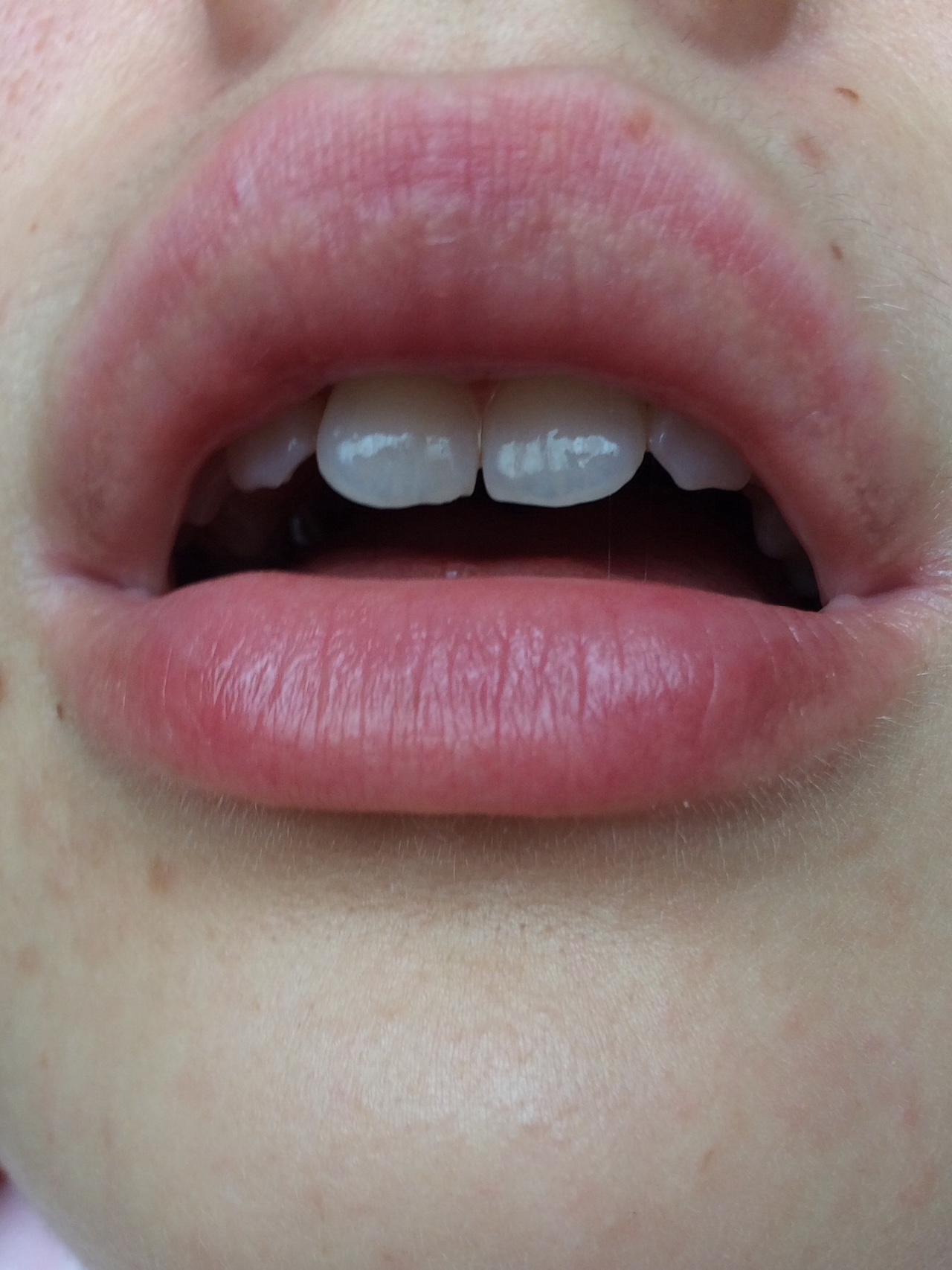 Половые губы в 14 лет фото