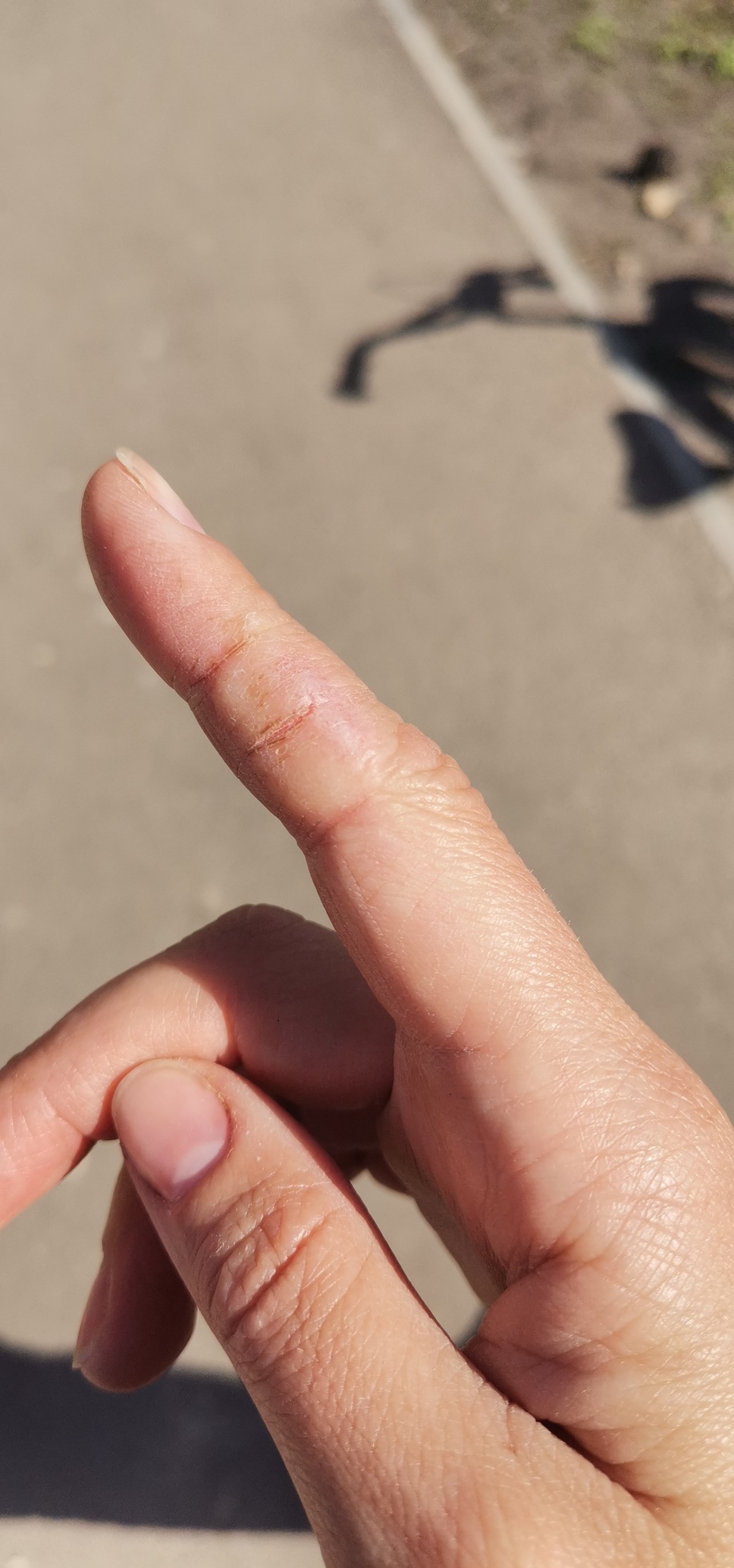 Трещины на указательном пальце