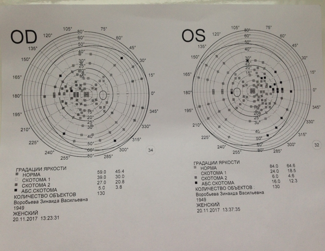Расшифровка зрения на аппарате. Периметрия поля зрения норма. Расшифровка компьютерной периметрии полей зрения. Исследование полей зрения периметрия норма. Периметрия поля зрения скотома 1.