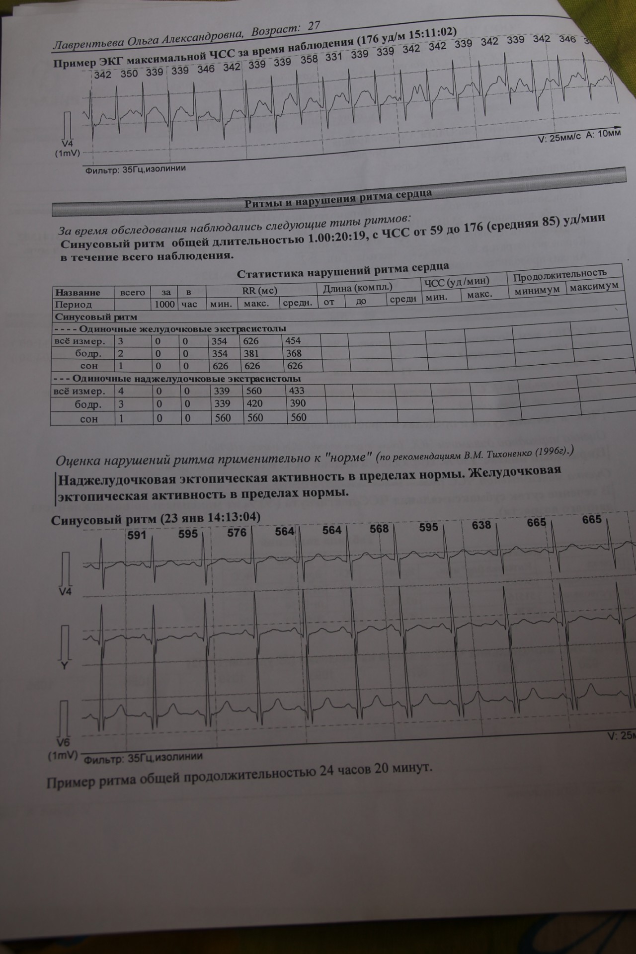 Исследование суточного