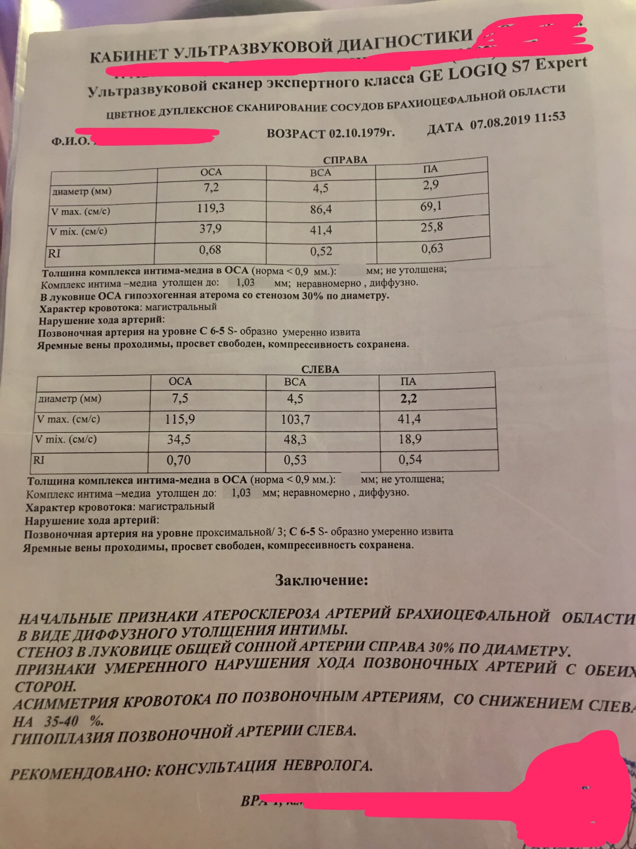 Сужение лица на фото онлайн