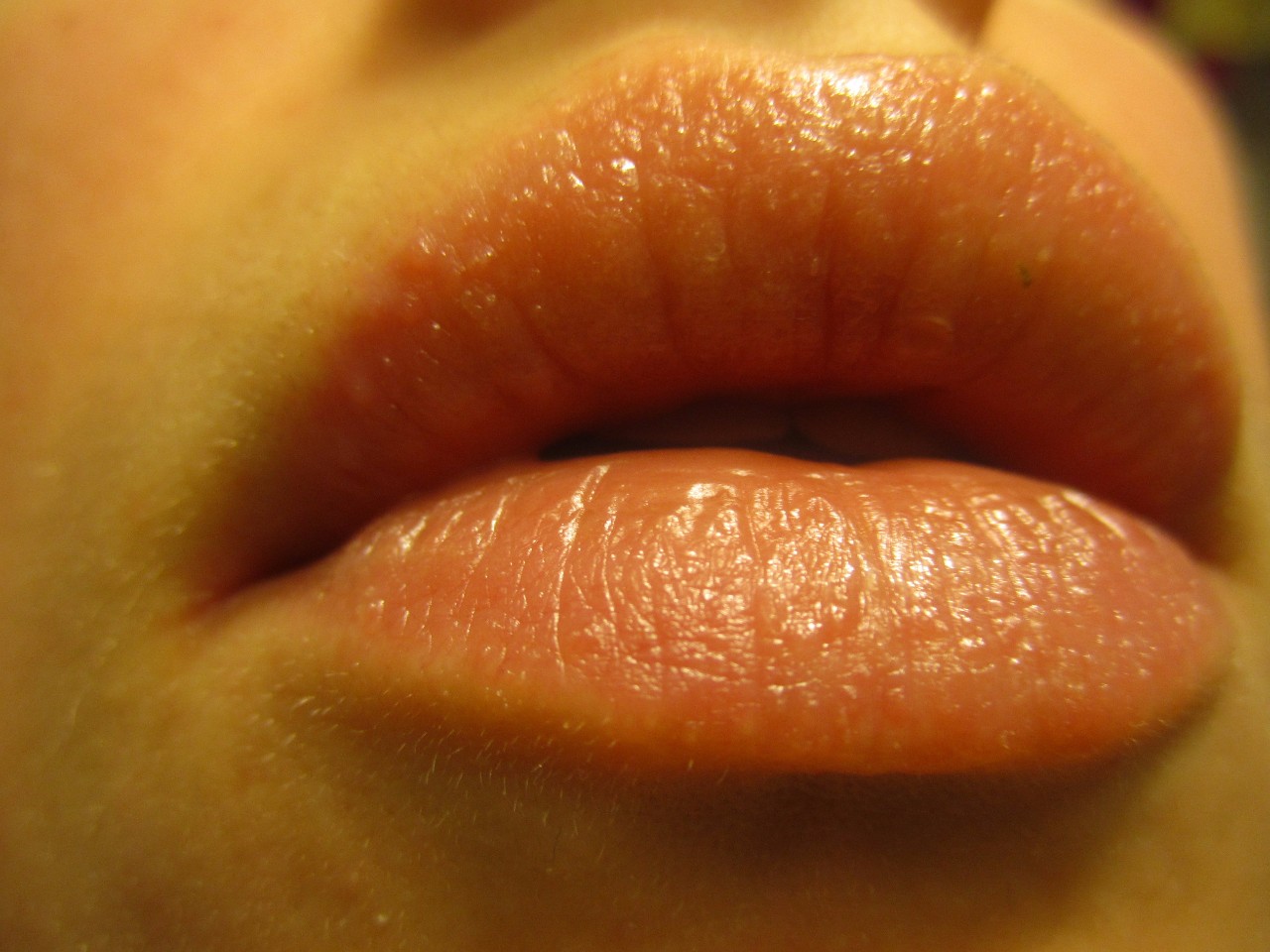 Воспаление желез на половых губах фото