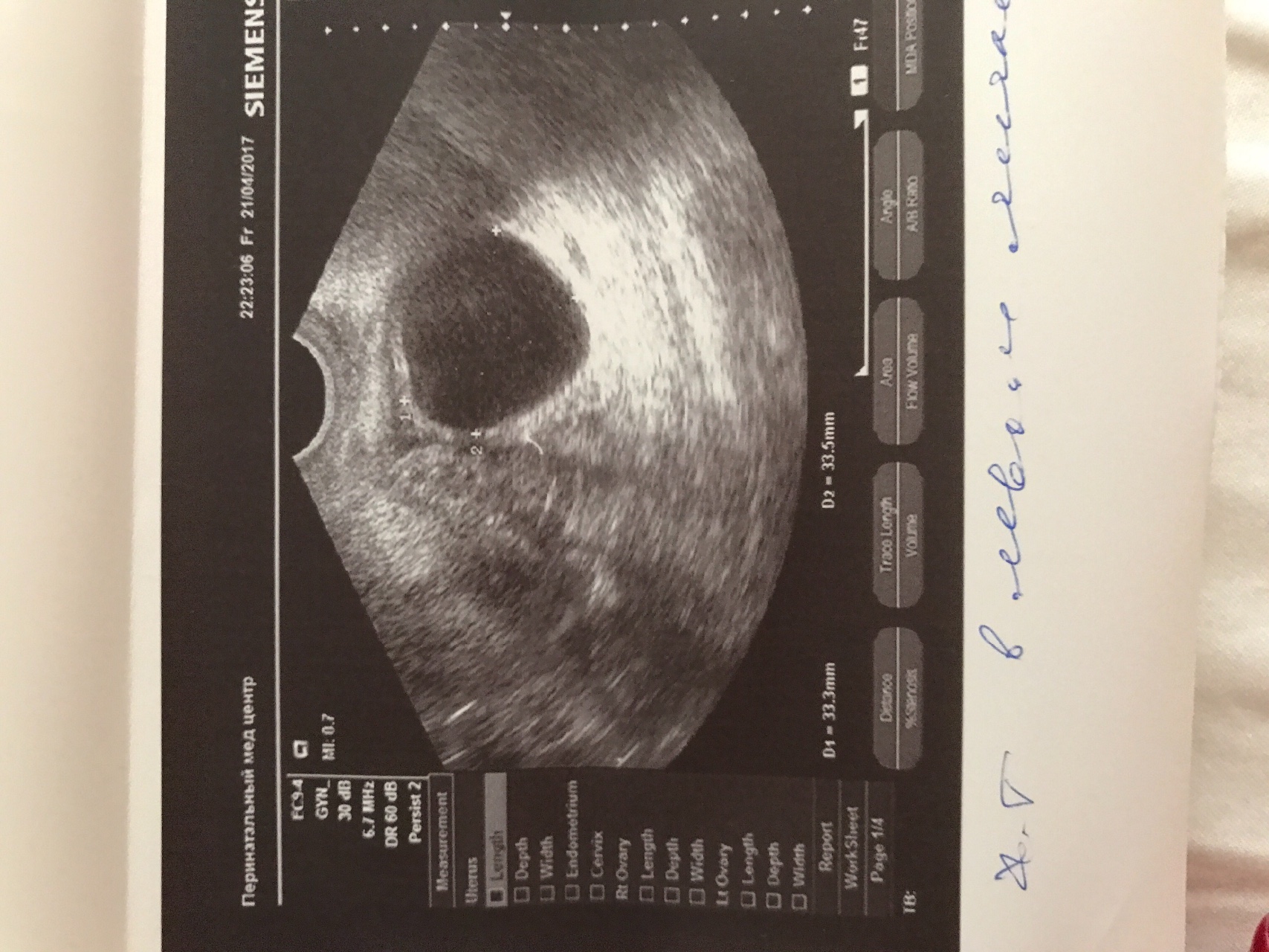 беременность 5 недель грудь мягкая фото 68