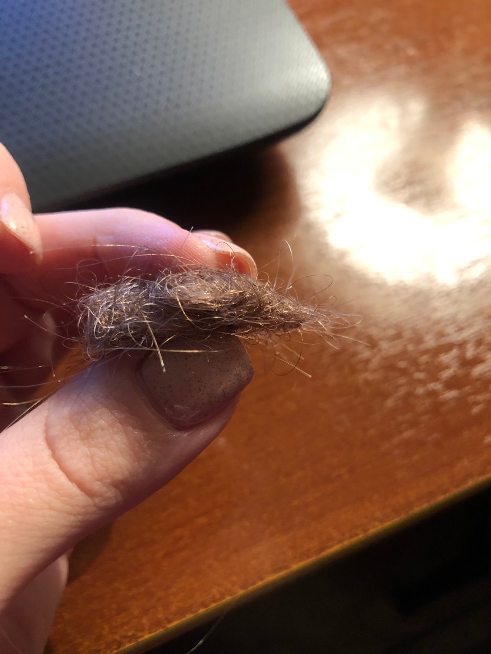 Как выглядит волосяная луковица на выпавшем волосе фото