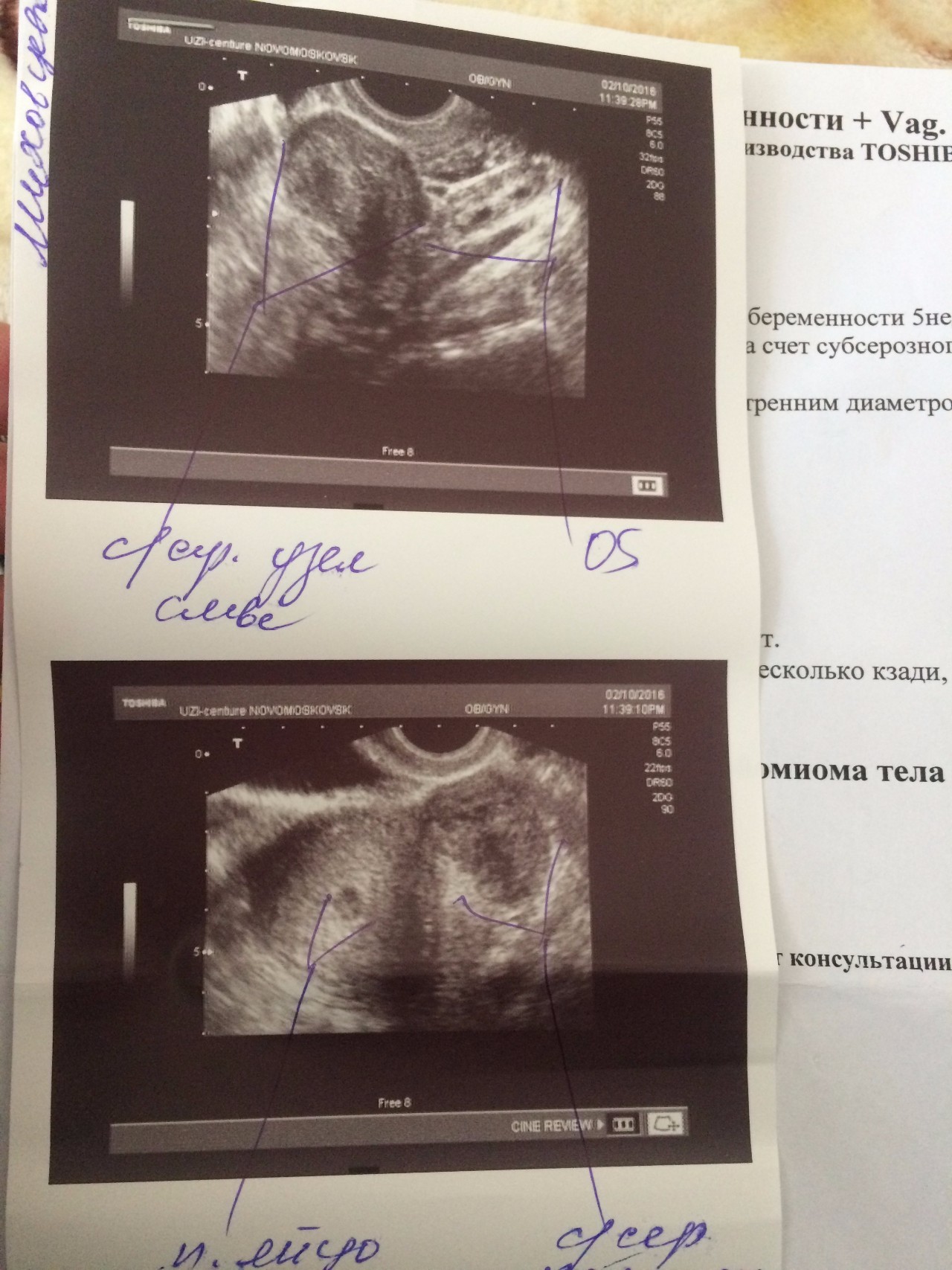 оргазм и гипертонус матки при беременности фото 35