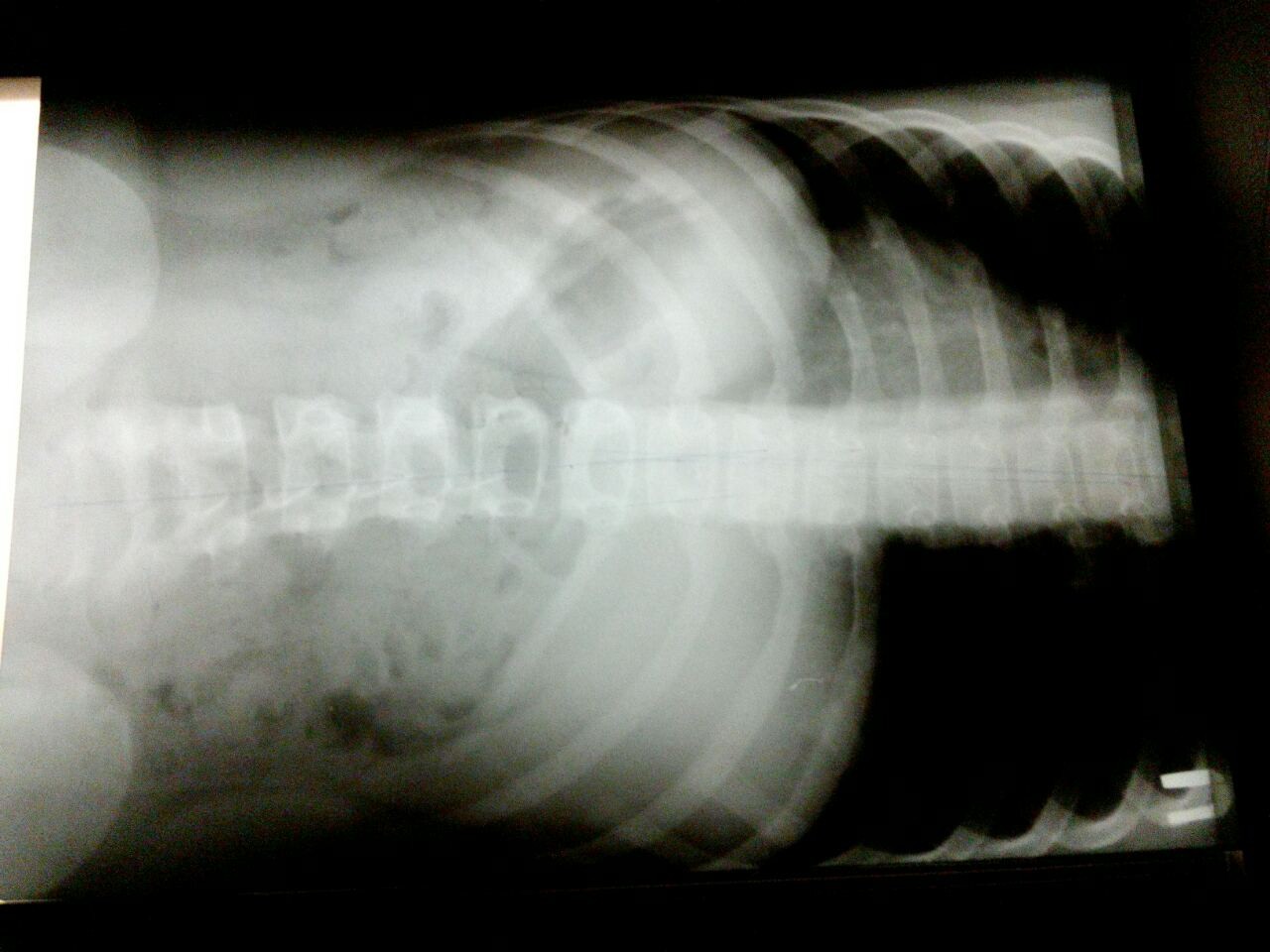 сделать рентген бутово