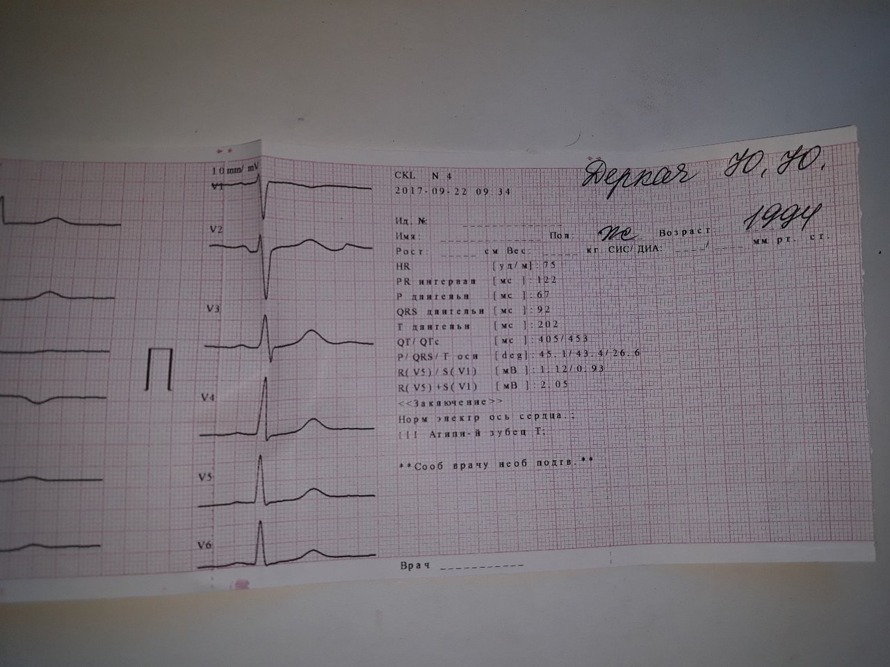 расшифровка кардиограммы сердца по фото