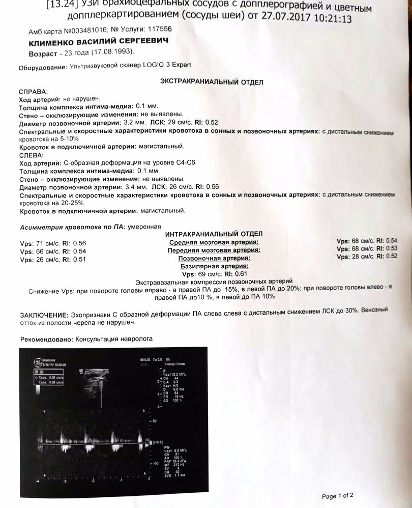 Срок годности узи нижних конечностей. Протоколы УЗИ сосудов шеи норма. Показатели норма УЗДГ брахиоцефальных артерий. УЗИ сосудов головного мозга протокол.